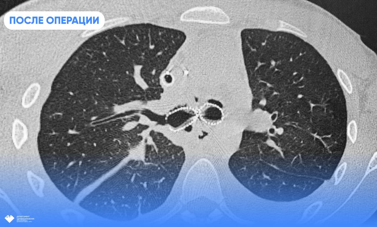 В Нижневартовске молодого человека перемололо в мукомольной машине