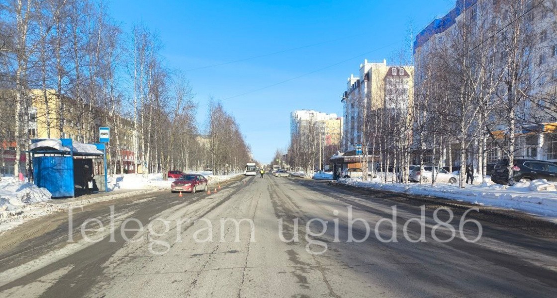 В Нижневартовске машина сбила девочку, которая выбежала на проезжую часть