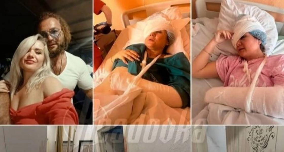 Житель Нижневартовска искалечил спящую бывшую гаечным ключом