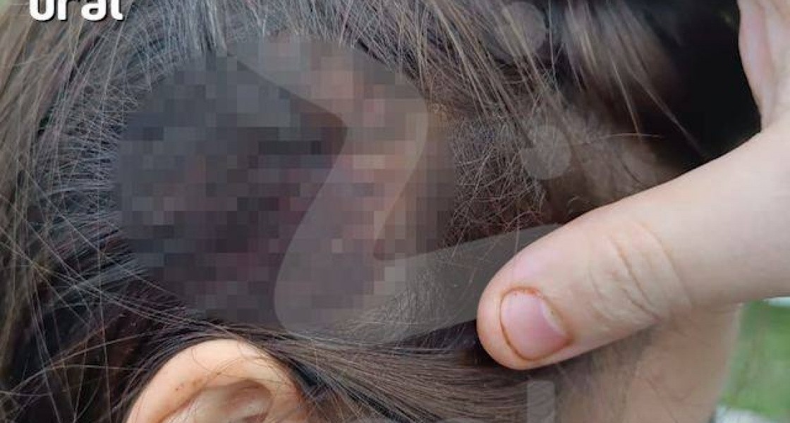 В Нижневартовске студентка ранила себя во время вечеринки